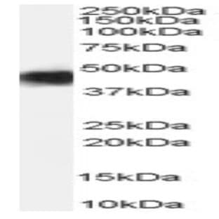anti-Cerebral Cavernous Malformation 2 (CCM2) (Internal Region) antibody