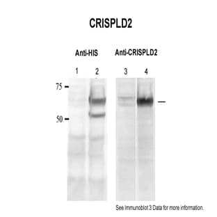 anti-Cysteine-Rich Secretory Protein LCCL Domain Containing 2 (CRISPLD2) (N-Term) antibody avatar