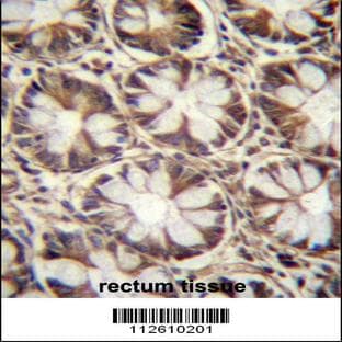 anti-Autophagy Related 10 (ATG10) (C-Term), (AA 96-121) antibody avatar