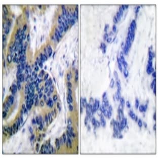 anti-Caspase 6, Apoptosis-Related Cysteine Peptidase (CASP6) (Cleaved-Asp162) antibody avatar