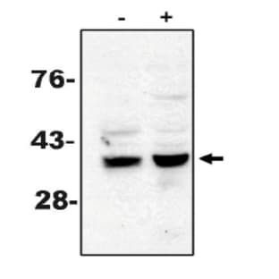 anti-Caspase 7, Apoptosis-Related Cysteine Peptidase (CASP7) antibody avatar