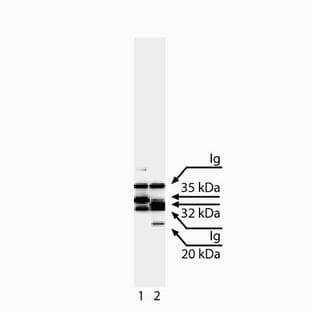 anti-Caspase 7, Apoptosis-Related Cysteine Peptidase (CASP7) antibody avatar
