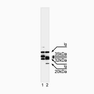 anti-Caspase 7, Apoptosis-Related Cysteine Peptidase (CASP7) (full length) antibody avatar