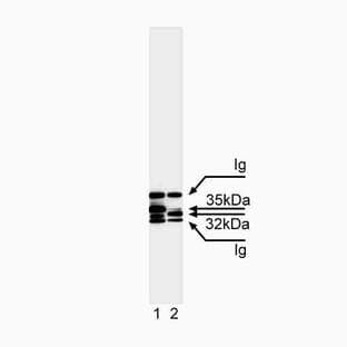 anti-Caspase 7, Apoptosis-Related Cysteine Peptidase (CASP7) (full length) antibody avatar