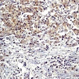 anti-Caspase 8, Apoptosis-Related Cysteine Peptidase (CASP8) (N-Term) antibody avatar