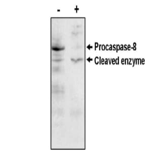 anti-Caspase 8, Apoptosis-Related Cysteine Peptidase (CASP8) antibody avatar