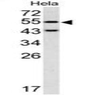 anti-Caspase 8, Apoptosis-Related Cysteine Peptidase (CASP8) (C-Term) antibody