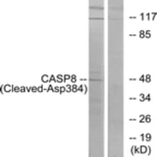 anti-Caspase 8, Apoptosis-Related Cysteine Peptidase (CASP8) (Cleaved-Asp384) antibody avatar