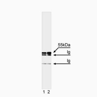 anti-Caspase 8, Apoptosis-Related Cysteine Peptidase (CASP8) (full length) antibody avatar