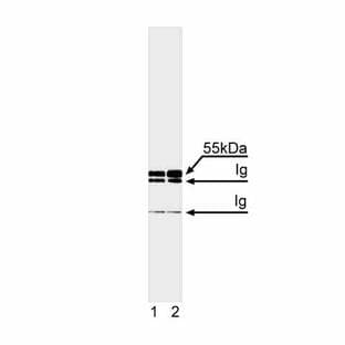 anti-Caspase 8, Apoptosis-Related Cysteine Peptidase (CASP8) (full length) antibody avatar