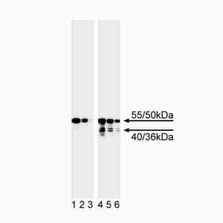 anti-Caspase 8, Apoptosis-Related Cysteine Peptidase (CASP8) antibody avatar