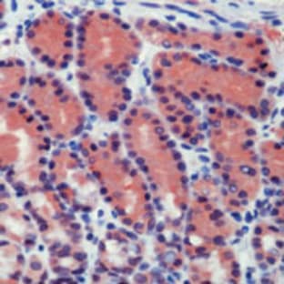 anti-Caspase 8, Apoptosis-Related Cysteine Peptidase (CASP8) antibody