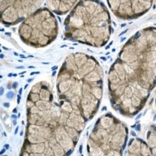 anti-Protein Phosphatase 1, Regulatory (Inhibitor) Subunit 1B (PPP1R1B) (C-Term) antibody