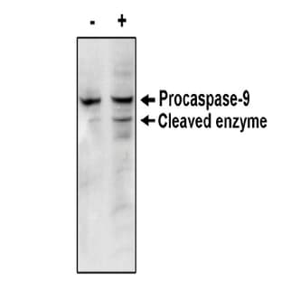 anti-Caspase 9, Apoptosis-Related Cysteine Peptidase (CASP9) antibody avatar