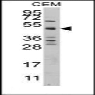 anti-Caspase 9, Apoptosis-Related Cysteine Peptidase (CASP9) (Middle Region) antibody avatar