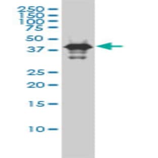 anti-Caspase 9, Apoptosis-Related Cysteine Peptidase (CASP9) (AA 1-417) antibody avatar