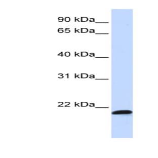 anti-Chromosome 21 Open Reading Frame 56 (C21orf56) (Middle Region) antibody avatar