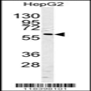 anti-Caspase 10, Apoptosis-Related Cysteine Peptidase (CASP10) (AA 164-192), (Center) antibody