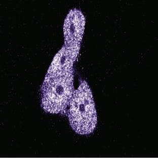 anti-Reversion-Inducing-Cysteine-Rich Protein with Kazal Motifs (RECK) (AA 559-760) antibody