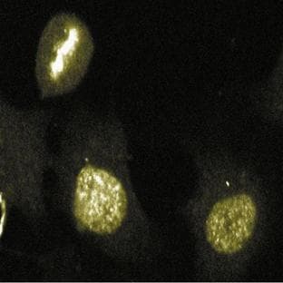 anti-Aurora Kinase B (AURKB) (AA 2-124) antibody avatar