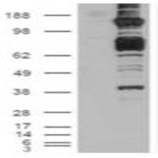 anti-Caspase Recruitment Domain Family, Member 11 (CARD11) (C-Term) antibody avatar