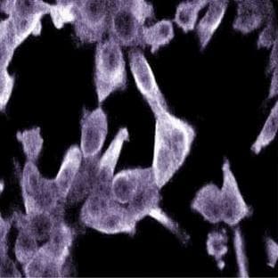 anti-DEAH (Asp-Glu-Ala-His) Box Polypeptide 16 (DHX16) (AA 256-366) antibody avatar