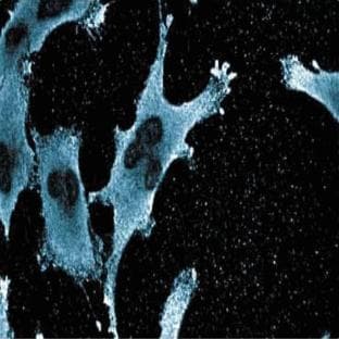 anti-Attractin (ATRN) (AA 184-383) antibody avatar