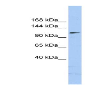 anti-SWI/SNF Related, Matrix Associated, Actin Dependent Regulator of Chromatin, Subfamily A, Member 5 (SMARCA5) (N-Term) antibody