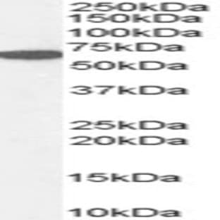 anti-Catalase (CAT) (Internal Region) antibody avatar