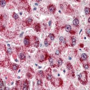 anti-Catalase (CAT) (Internal Region) antibody avatar