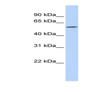 anti-Disrupted in Renal Carcinoma 2 (DIRC2) (Middle Region) antibody
