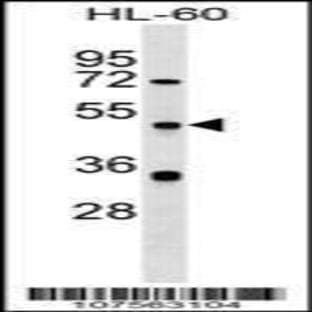 anti-Autophagy Related 4D, Cysteine Peptidase (ATG4D) (N-Term), (AA 14-43) antibody avatar