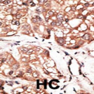 anti-Autophagy Related 4D, Cysteine Peptidase (ATG4D) (AA 220-249), (Center) antibody avatar