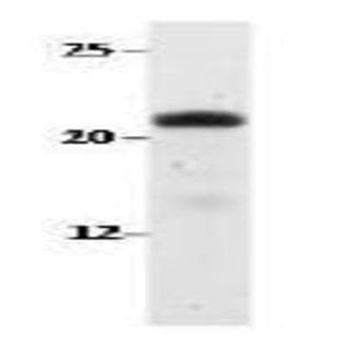 anti-Chromosome 3 Open Reading Frame 34 (C3orf34) (AA 133-153), (C-Term) antibody avatar