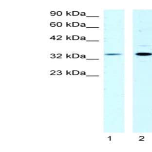 anti-Cold Shock Domain Protein A (CSDA) (N-Term) antibody avatar