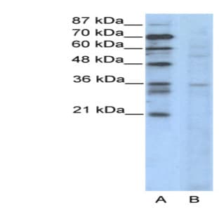 anti-Cyclin B3 (CCNB3) (N-Term) antibody avatar