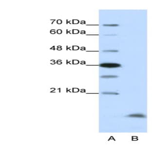 anti-Cyclin B3 (CCNB3) (N-Term) antibody avatar
