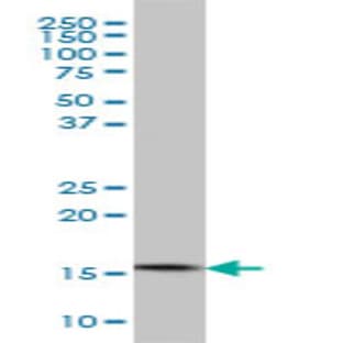 anti-CGG Triplet Repeat Binding Protein 1 (CGGBP1) (AA 58-168) antibody