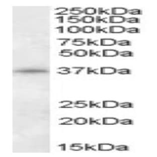 anti-Cyclin-Dependent Kinase 10 (CDK10) (N-Term), (Isoform A) antibody avatar