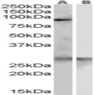 anti-Acetyl LDL Receptor (SCARF1) (Internal Region) antibody avatar