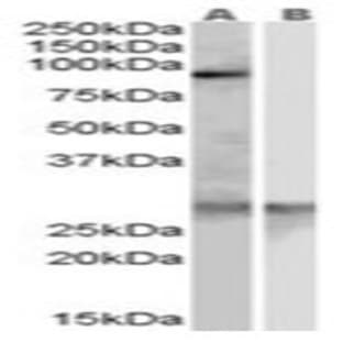 anti-Acetyl LDL Receptor (SCARF1) (Internal Region) antibody avatar