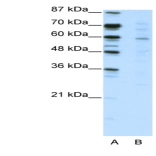 anti-Core-binding Factor, Runt Domain, alpha Subunit 2, Translocated To, 3 (CBFA2T3) (N-Term) antibody avatar