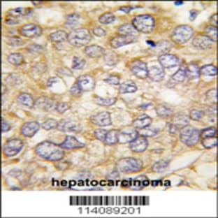 anti-Chordin (CHRD) (C-Term), (AA 926-955) antibody avatar