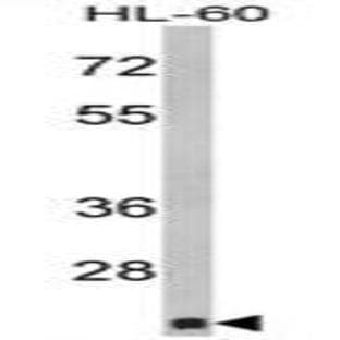 anti-Core-Binding Factor, beta Subunit (CBFB) (Middle Region) antibody avatar