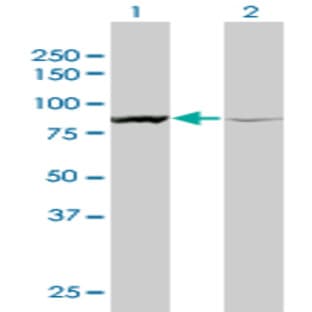 anti-Actinin, alpha 1 (ACTN1) (AA 543-640) antibody avatar