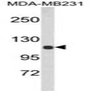 anti-Actinin, alpha 1 (ACTN1) (N-Term) antibody avatar