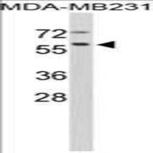 anti-Cathepsin F (CTSF) (Middle Region) antibody avatar