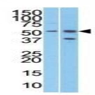 anti-Chromosome 19 Open Reading Frame 2 (C19orf2) (C-Term) antibody avatar