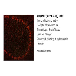 anti-ADAM Metallopeptidase Domain 15 (ADAM15) (Middle Region) antibody avatar