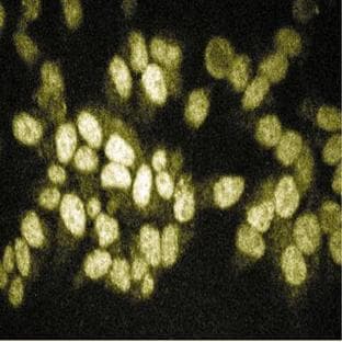 anti-Receptor-Interacting Serine-threonine Kinase 2 (RIPK2) (AA 333-532) antibody